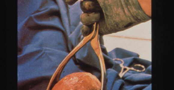 10 razones sus hijos a ver a un Doctor en Quiropráctica