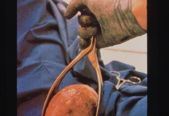 10 razones sus hijos a ver a un Doctor en Quiropráctica