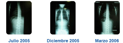 how chiropractic works Dr. Marc Bony, DC