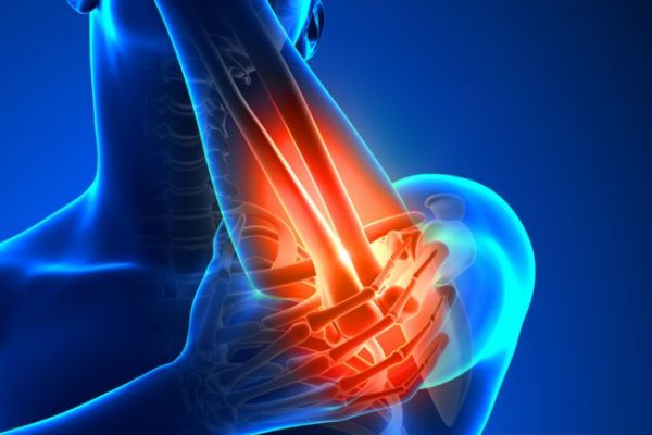 Tendinitis articulacion