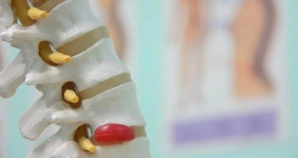 Dolores de caderas Barcelona