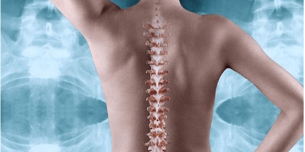 Artrosis proceso de degeneración espinal