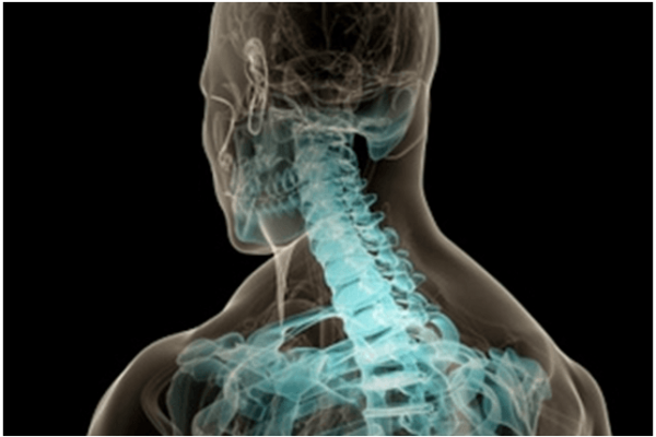 Subluxación un peligro silencioso