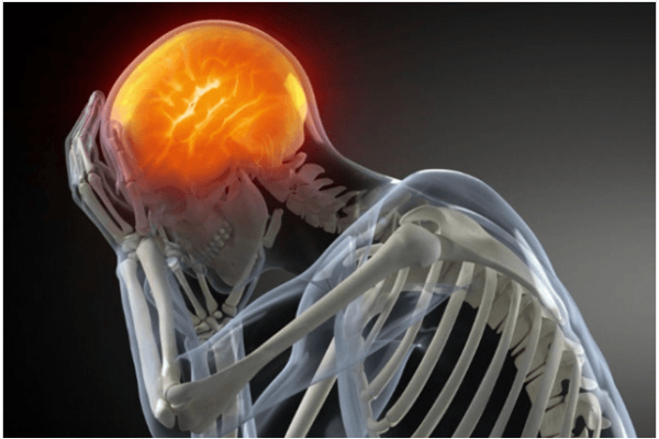 dolor de cabeza  Granollers