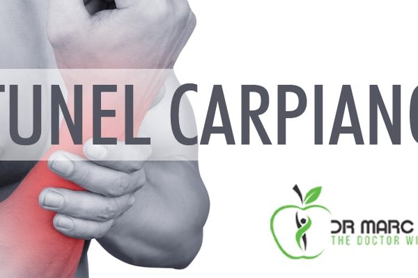 Túnel Carpiano y la Quiropráctica