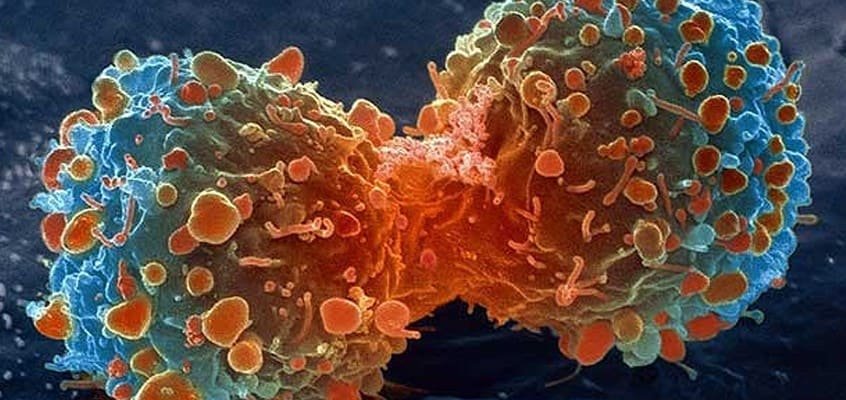 El mejor tratamiento para el cáncer