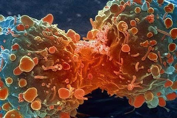 El mejor tratamiento para el cáncer