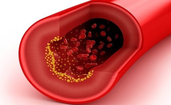 El Colesterol no es "Bueno" ni "Malo"