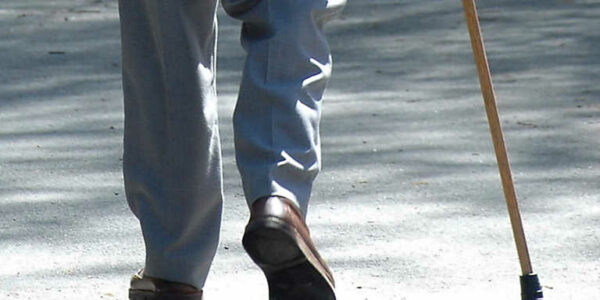 Síndrome de translación de la cabeza