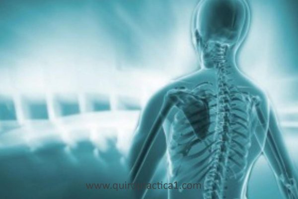 Quiropráctica y esclerosis multiple