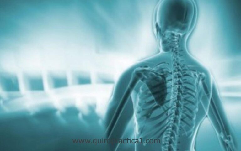 Quiropráctica y esclerosis multiple